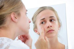 Da mặt nổi hột ngứa nguyên nhân và cách chữa trị