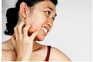 Da mặt ngứa rát nguyên nhân và cách khắc phục hiệu quả