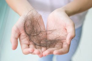 Nguyên nhân và cách điều trị rụng tóc hiệu quả