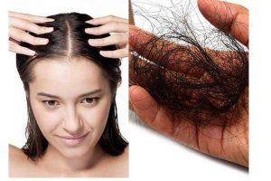 Nguyên nhân rụng tóc và giải pháp điều trị hiệu quả