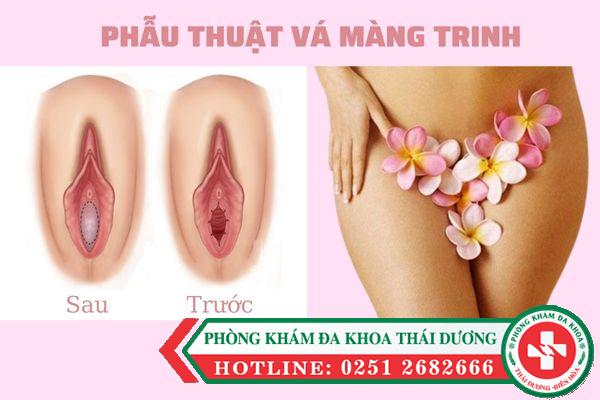 chi-phi-va-mang-trinh-bao-nhieu-tien-co-dat-khong (2)